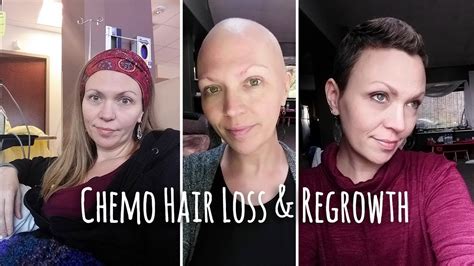 How Long After First Chemo Will Hair Fall Out MedBeautys