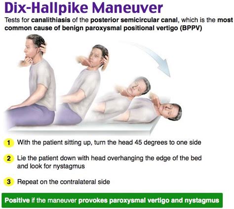 Rosh Review On Twitter What Defines A Positive Dix Hallpike Maneuver