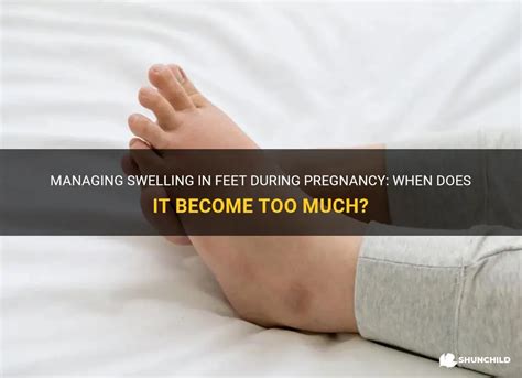 Managing Swelling In Feet During Pregnancy When Does It Become Too