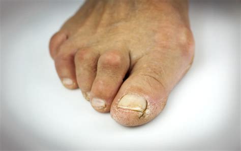 Atlanta Podiatrists Atlanta Foot And Ankle Specialists Do You Have
