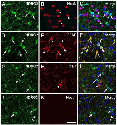 Frontiers Ndrg Regulates The Formation Of Reactive Astrocyte Derived