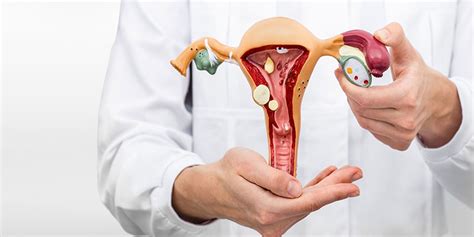 What Is Ovarian Cancer Symptoms Causes Risk Factors Signs Stages