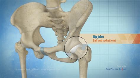 Learn more about hip injections. Treatments - Spine Pain Indore