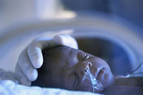 Respiratory Support For Premature Babies In The Nicu