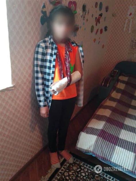 Новини Одеси в школі розгорівся скандал школярка зламала руку а вчителька мовчала — Укрaїнa