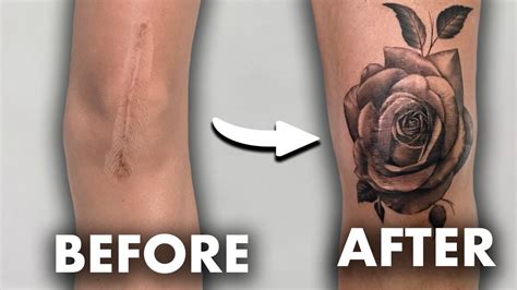 Cover Your Scars And Stretch Marks With A Tattoo Youtube