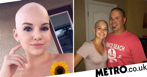 Dad Shaves Head In Bid To Encourage Daughter With Alopecia To Embrace Her Beauty Metro News
