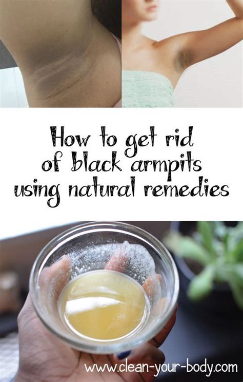 How To Get Rid Of Black Armpits Using Natural Remedies 564×886
