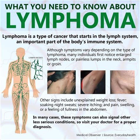 What Is Lymphoma Diagnosis Iswatq