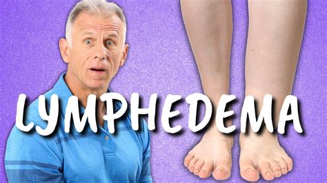 Exercises For Leg Lymphedema Swelling Or Edema Of The Lower Extremities YouTube