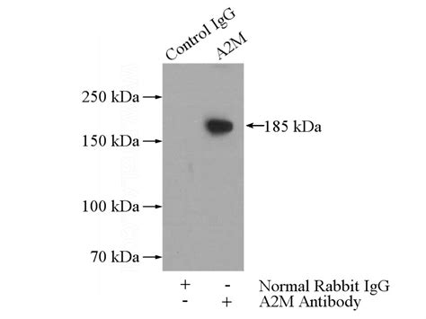 Alpha 2 Macroglobulin Rabbit Polyclonal Antibody