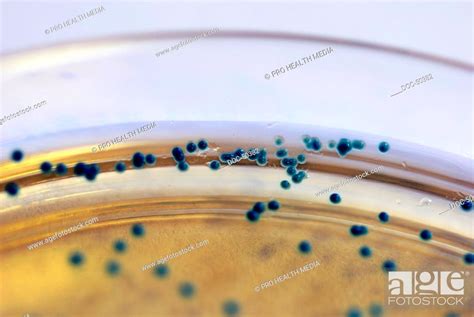 Culture With Candida Albicans Stock Photo Picture And Rights Managed