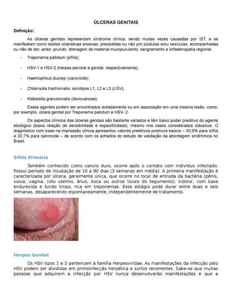 Úlceras genitais Ginecologia ÚLCERAS GENITAIS Definição As úlceras