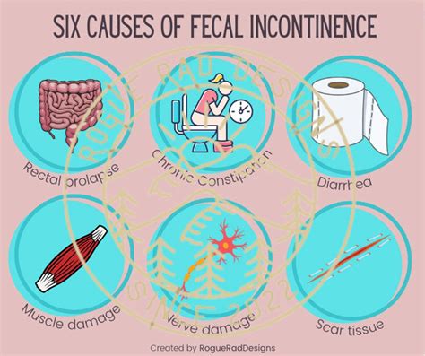 Editable Causes Of Fecal Incontinence Infograph Etsy