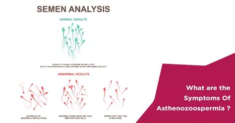 What Are The Signs And Symptoms Of Asthenozoospermia Nova Ivf Fertility