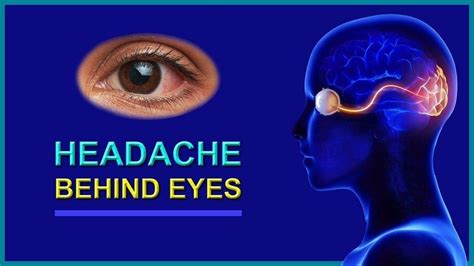 What To Know About A Headache Behind The Eyes