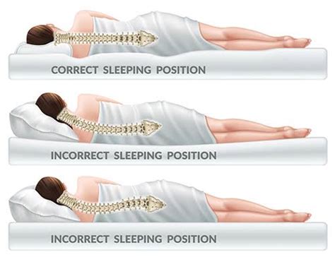You should also know how to sleep to fix posture. The Best Sleeping Position For Back Pain? - Chiropractic ...