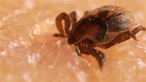 How Ticks Dig In With A Mouth Full Of Hooks Kqed