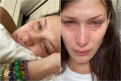 model bella hadid opens up about her mental health struggles the straits times