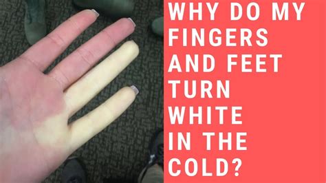 why do my fingers turn white in the cold raynaud s syndrome youtube