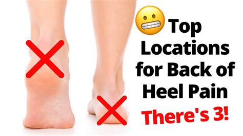 Back Of The Heel Pain Locations Youtube