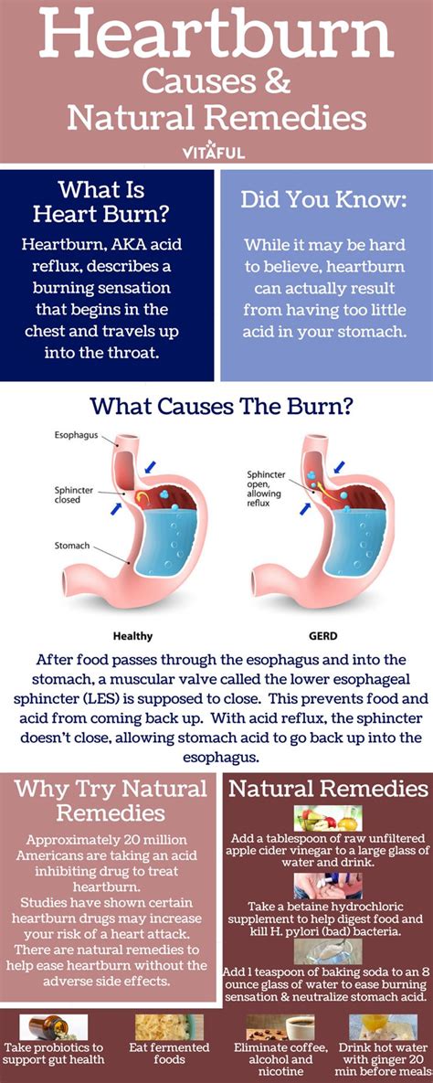 Health Infographic An Overview Of Heartburn Includes Heartburn