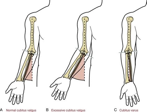 Structure And Function Of The Elbow And Forearm Complex