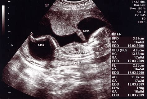 17 Weeks Pregnant Symptoms Ultrasound And Fetus Development