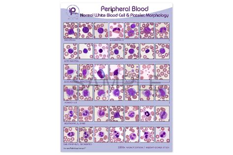 Peripheral Blood Normal White Blood Cell And Platelet Morphology