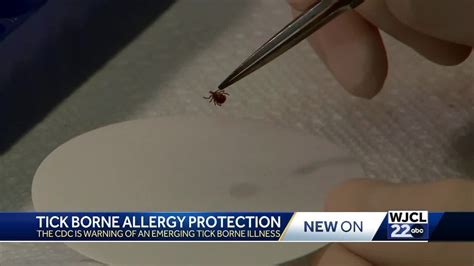 Certain Tick Bites Can Cause A Red Meat Allergy Savannah Doctor