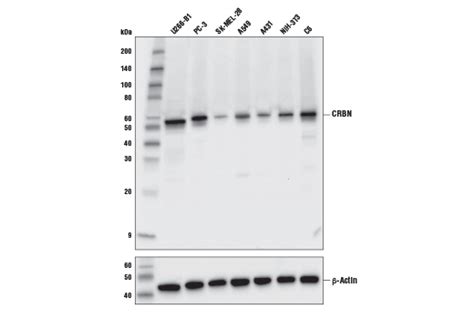 Or any of the other 9309 slang words, abbreviations and acronyms listed here at internet slang? CRBN (D8H3S) Rabbit mAb | Cell Signaling Technology