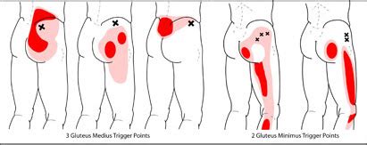 The three muscles originate from the ilium and sacrum and insert on the femur. Are your glutes a pain in your bottom?! - Cocoon Boutique