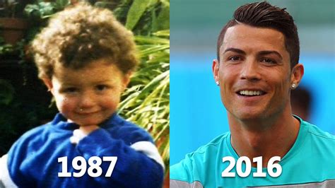Cristiano Ronaldo Transformation Before And After Face And Hair And Teeth