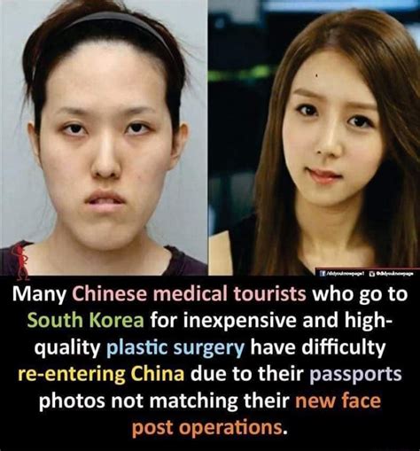 Many Chinese Medical Tourists Who Go To South Korea For Inexpensive And High Quality Plastic