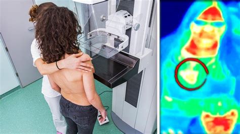 Tourist Spot’s Thermal Camera Detects Woman S Breast Cancer Youtube