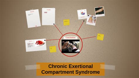 Chronic Exertional Compartment Syndrome By