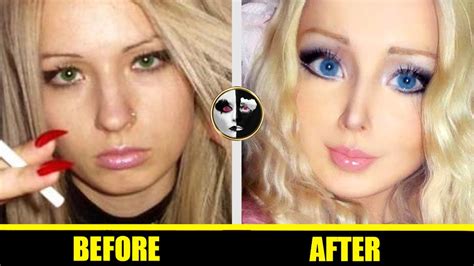 Valeria Lukyanova 👧 Barbie Doll Plastic Surgery Before And After 👧 Hot Beautiful Girls