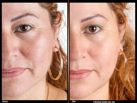 ItsCamillaAra.USA: Before & After Photos You HAVE To See