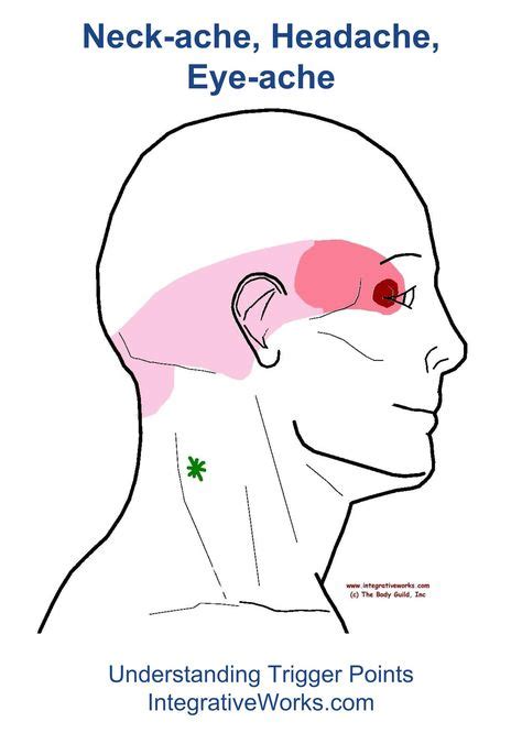 Suboccipital Group Trigger Point Diagram Triggers Points Therapy