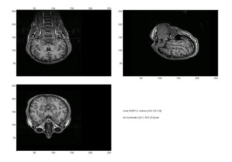 How To Change The Mri Orientation The Voxel Size Or The Field Of View