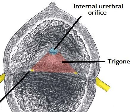 Urinary Retention Clinical Features Management Teachmesurgery