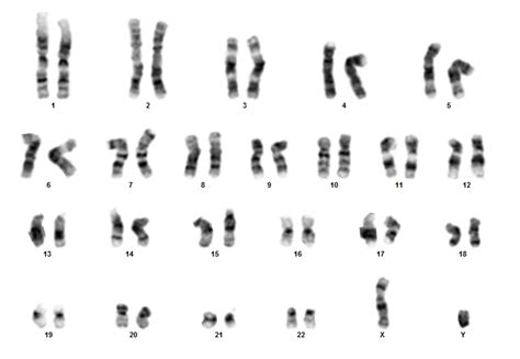 Karyotype Examples Hot Sex Picture