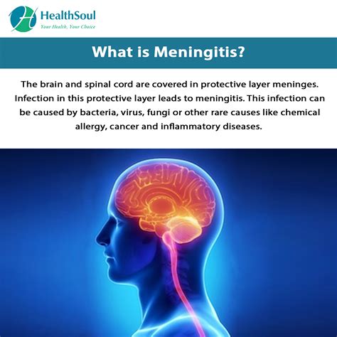 Meningitis Meningitis Causes Symptoms And Treatment Dusek Gosented