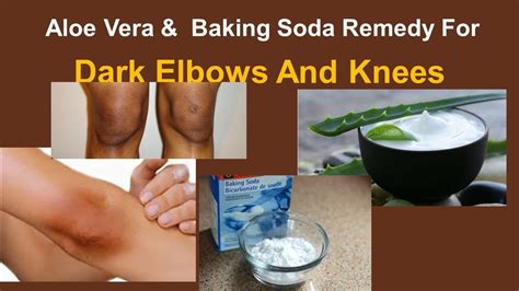 Home Remedies For Dark Elbows And Knees Aloe Vera And Baking Soda