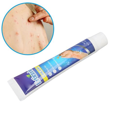 Buy Itching Cream Pruritus Ointment For Dry Skin Adjunctive Treatment