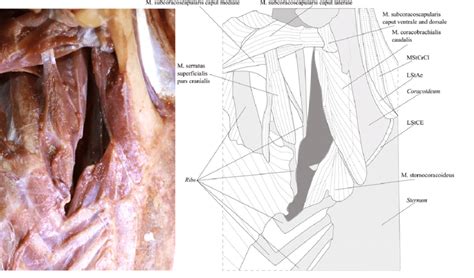 Deltoid (posterior fibers), teres major, teres minor, latissimus dorsi, pectoralis major (sternocostal fibers). Ventral view of the deep muscles of the right shoulder ...