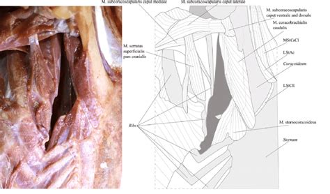 Supraspinatus muscle raises the shoulder and pulls the shoulder joint capsule, must not be pinched. Ventral view of the deep muscles of the right shoulder girdle of the... | Download Scientific ...