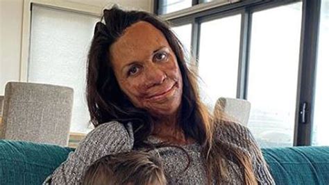 Turia Pitt S Instagram For Fire Affected Businesses Overwhelmed By Support 9honey