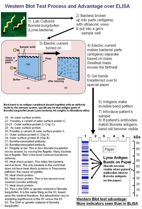 When Life Gives You Lyme Elisa And Western Blot Tests For Dummies