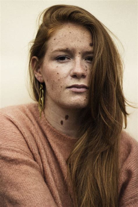 This Redhead Stopped Hiding Her Freckles And It Will Inspire You